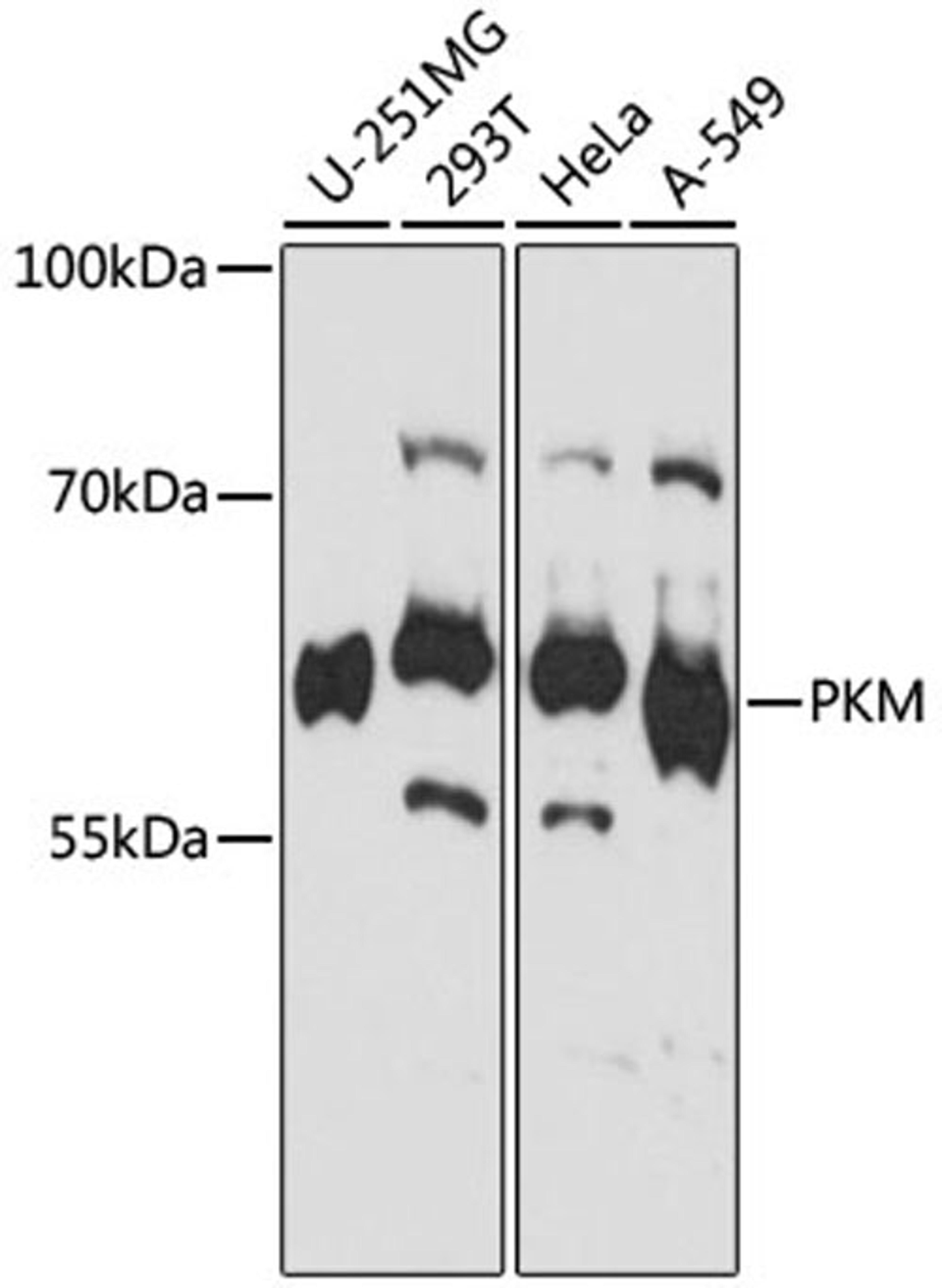 Western blot - PKM antibody (A16700)