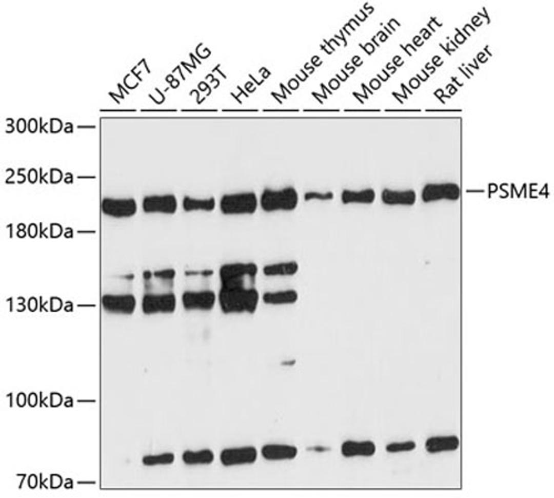 Western blot - PSME4 antibody (A13815)