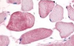 Immunohistochemistry-Paraffin: CCNL1 Antibody [NBP1-77747] - This antibody was used at a 10ug/mL in a variety of tissues including breast, kidney, liver, lung, skeletal muscle, pancreas, prostate and spleen. In some tissues elevated background staining was noted. In these instances further optimization of dilution is suggested. This image shows Cyclin L staining of human skeletal muscle.