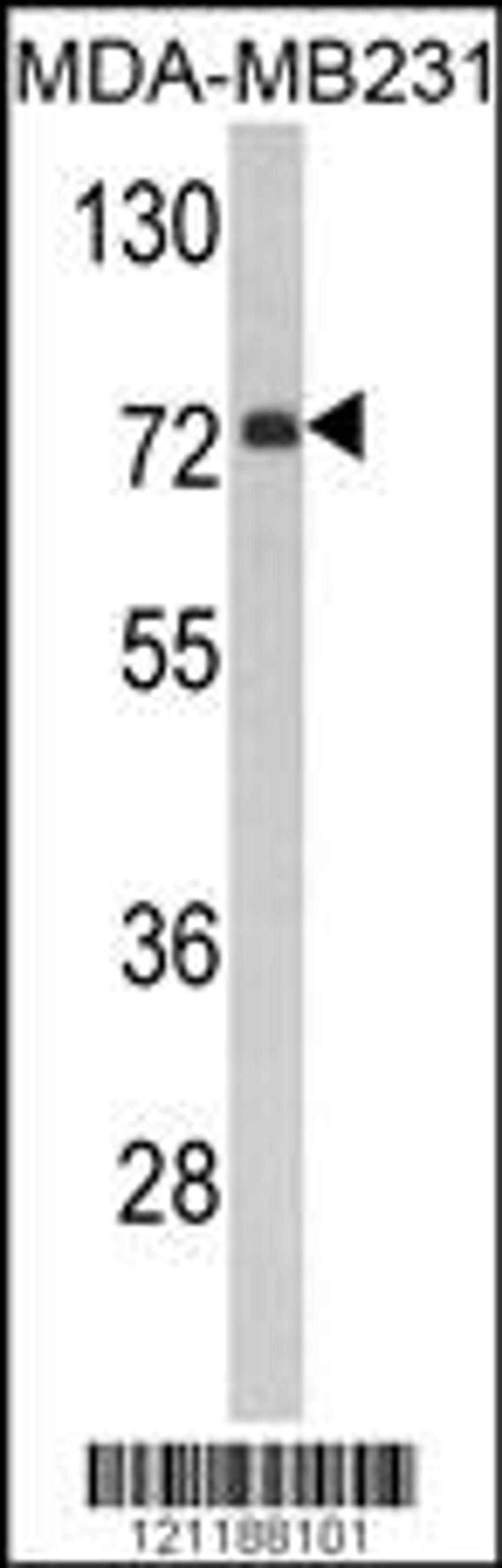 Western blot analysis of FMO3 Antibody in MDA-MB231 cell line lysates (35ug/lane)