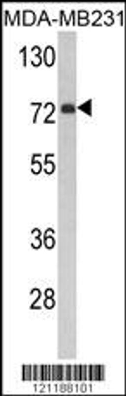 Western blot analysis of FMO3 Antibody in MDA-MB231 cell line lysates (35ug/lane)