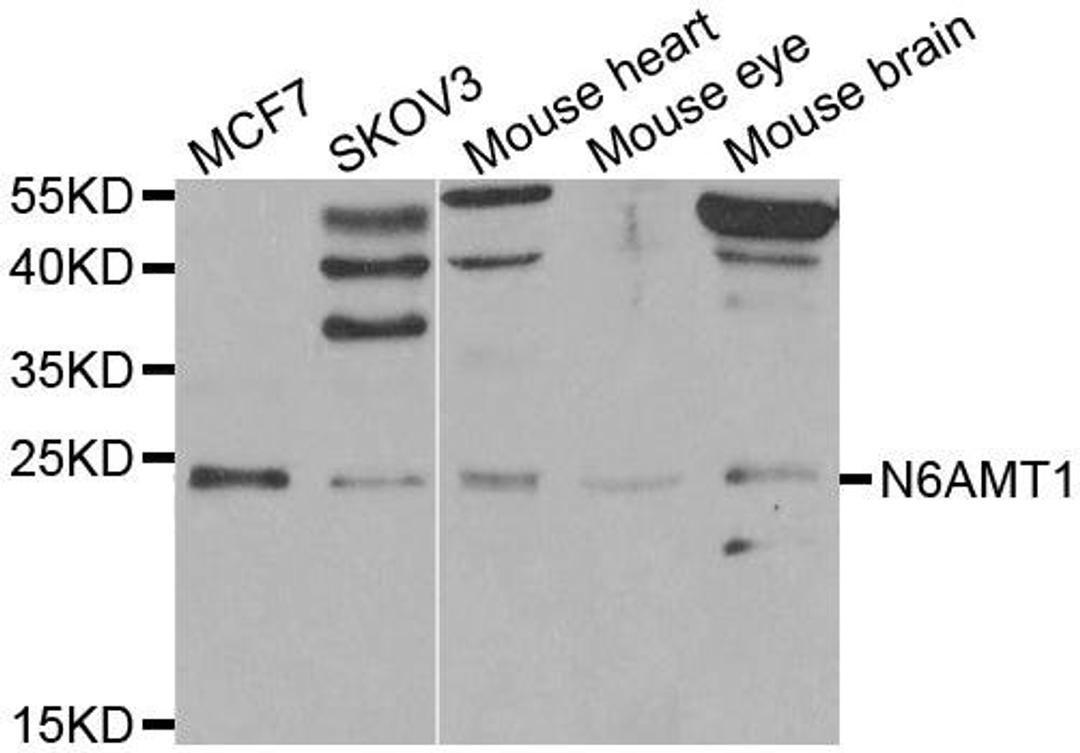 Western blot analysis of extracts of various cell lines using N6AMT1 antibody