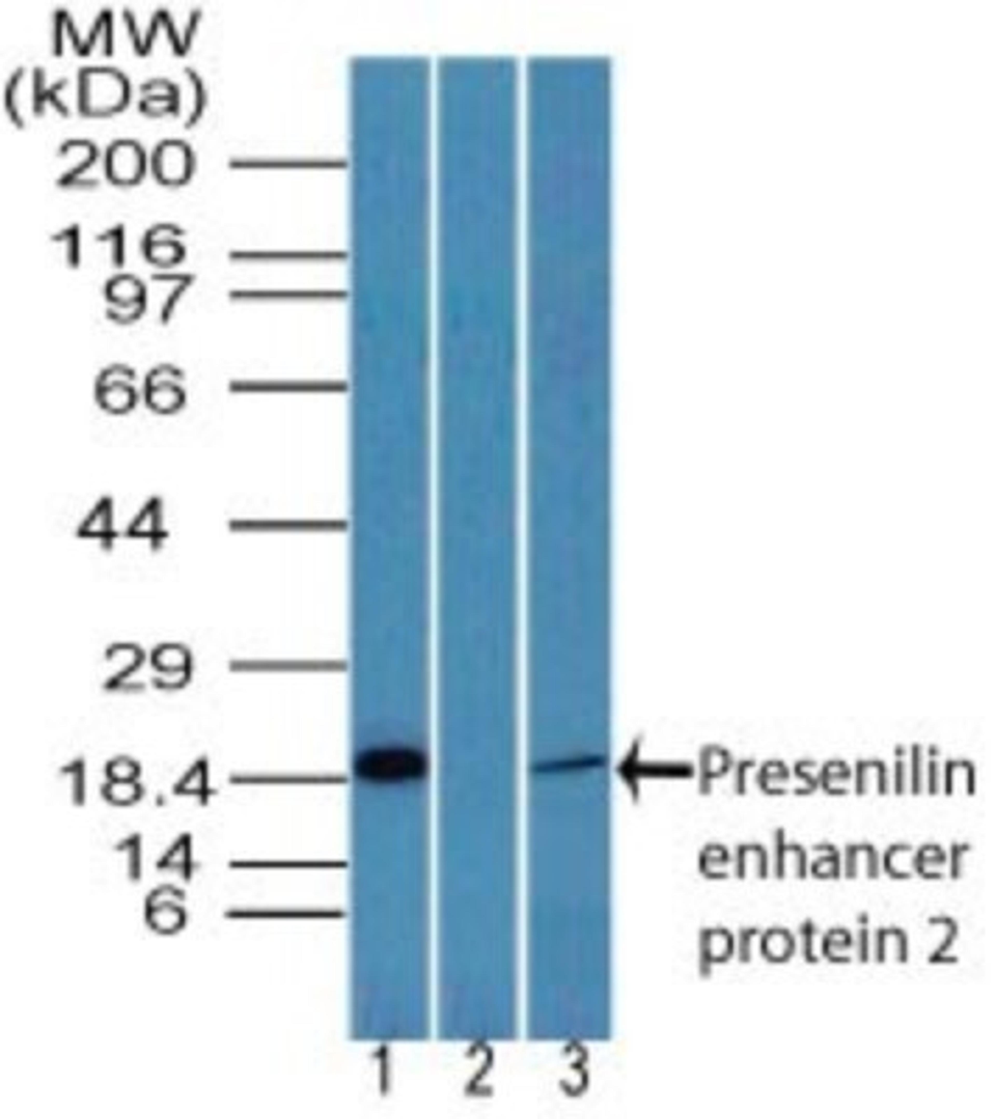 Western Blot: PEN2 Antibody [NBP2-24611] - Analysis of Presenilin enhancer protein 2 in human intestine lysate in the 1) absence and 2) presence of immunizing peptide and 3) mouse intestine lysate using NBP2-24611. Goat anti-rabbit Ig HRP secondary antibody and PicoTect ECL substrate solution were used for this test.