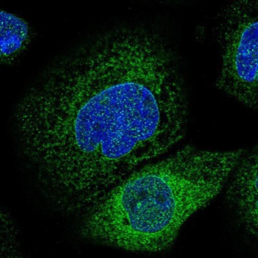 Immunocytochemistry/Immunofluorescence: LASS2 Antibody [NBP1-84537] Staining of human cell line A-431 shows positivity in nuclear membrane & endoplasmic reticulum.