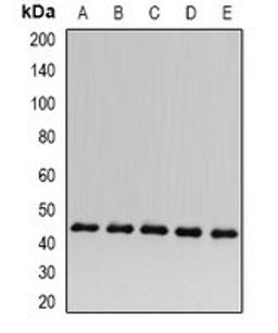 Western blot analysis of HepG2 (Lane1), Hela (Lane2), mouse kidney (Lane3), rat heart (Lane4), rat liver (Lane5) whole cell lysates using ACADS antibody