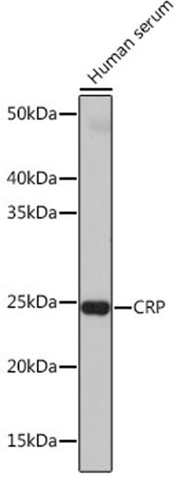 Western blot - CRP antibody (A19003)