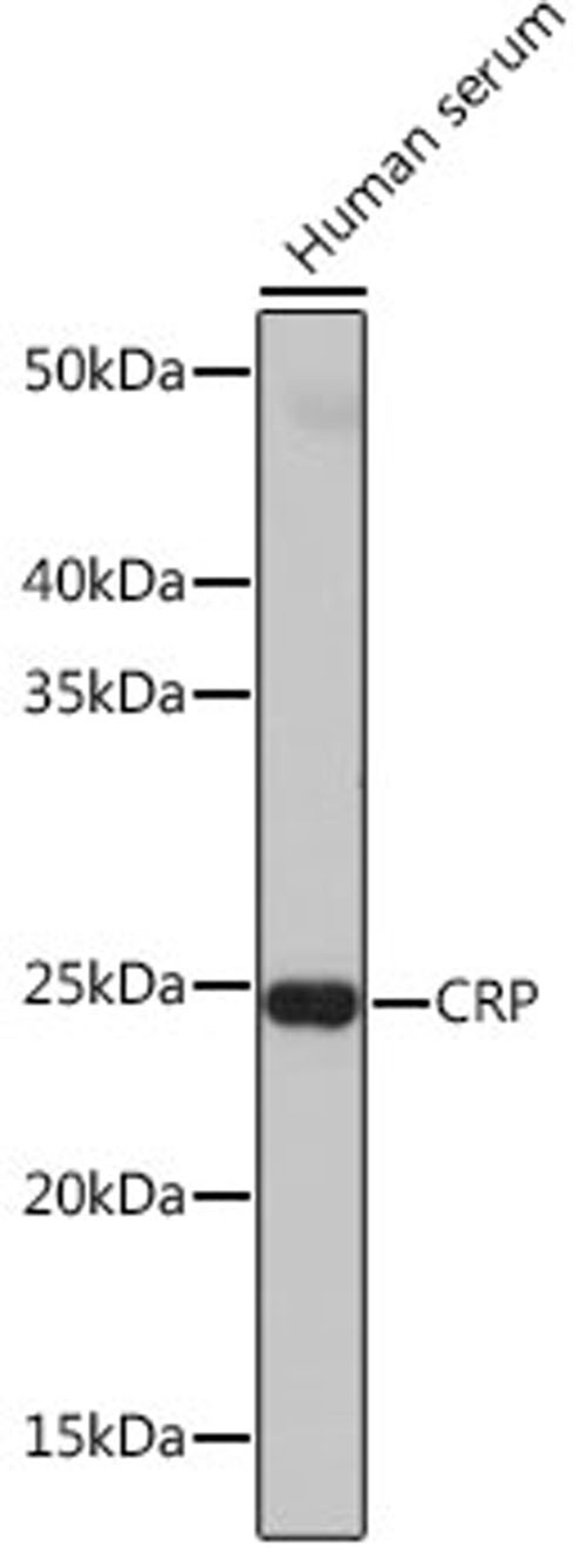 Western blot - CRP antibody (A19003)