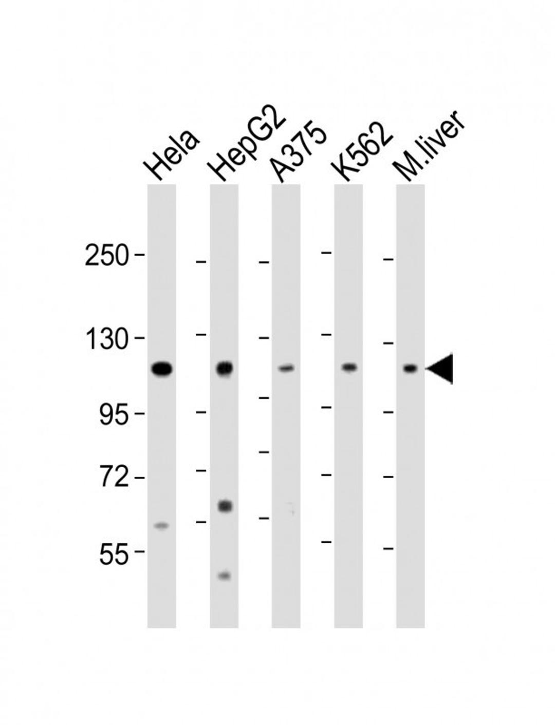 Western Blot at 1:2000 dilution Lane 1: Hela whole cell lysate Lane 2: HepG2 whole cell lysate Lane 3: A375 whole cell lysate Lane 4: K562 whole cell lysate Lane 5: mouse liver lysate Lysates/proteins at 20 ug per lane.