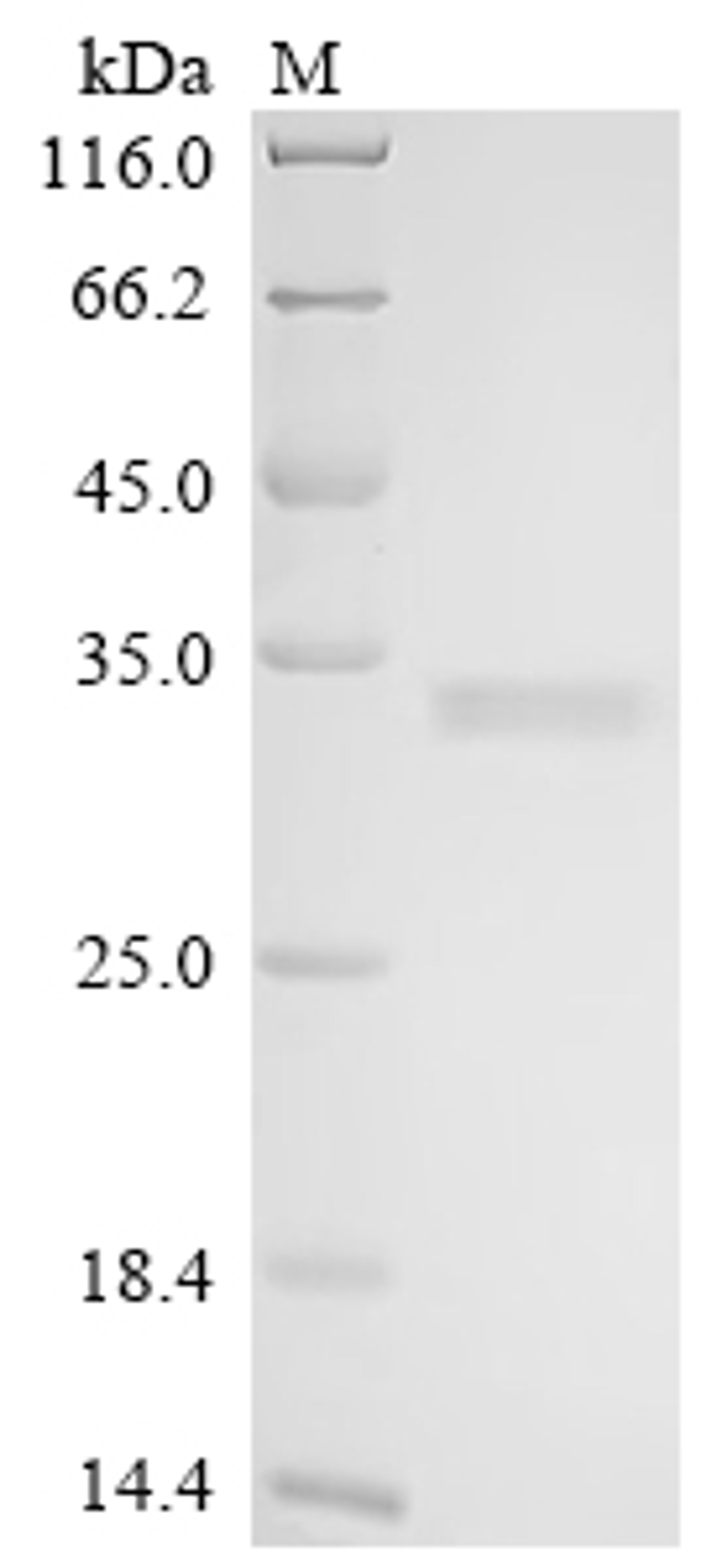 (Tris-Glycine gel) Discontinuous SDS-PAGE (reduced) with 5% enrichment gel and 15% separation gel.