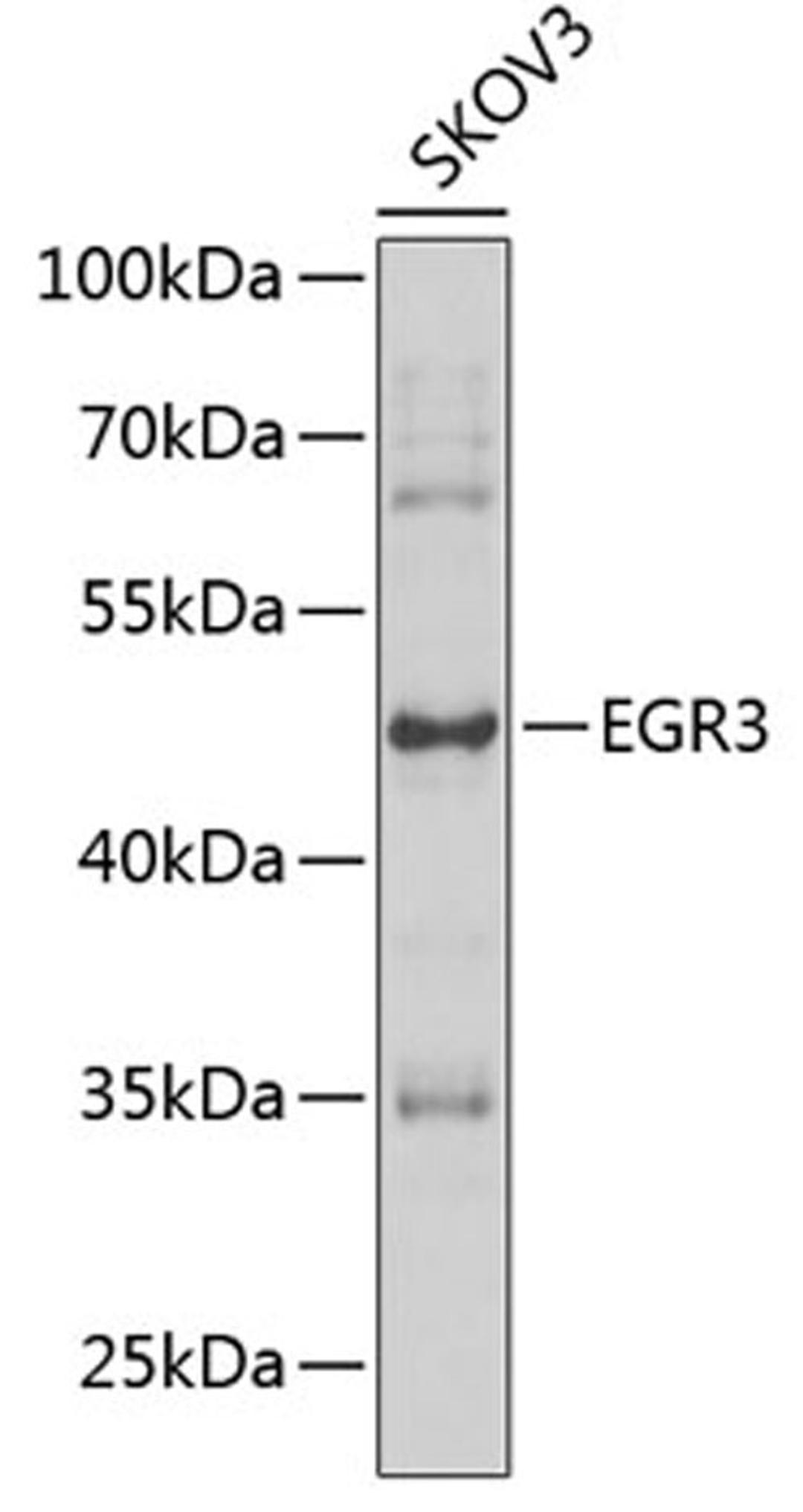 Western blot - EGR3 antibody (A7669)