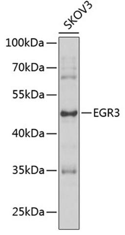 Western blot - EGR3 antibody (A7669)