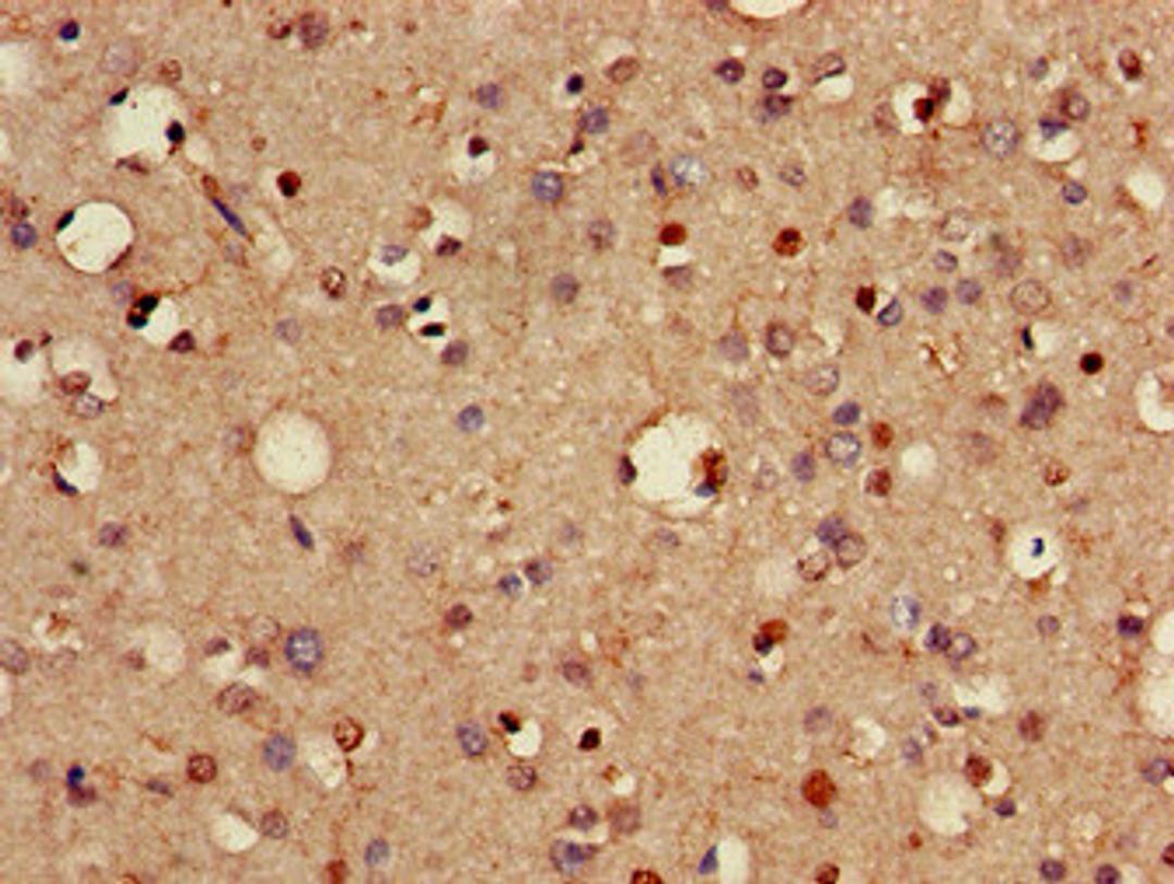 Immunohistochemistry of paraffin-embedded human brain tissue using CSB-PA842635LA01HU at dilution of 1:100