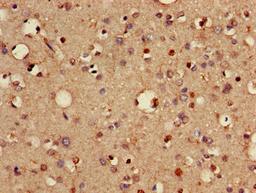 Immunohistochemistry of paraffin-embedded human brain tissue using CSB-PA842635LA01HU at dilution of 1:100