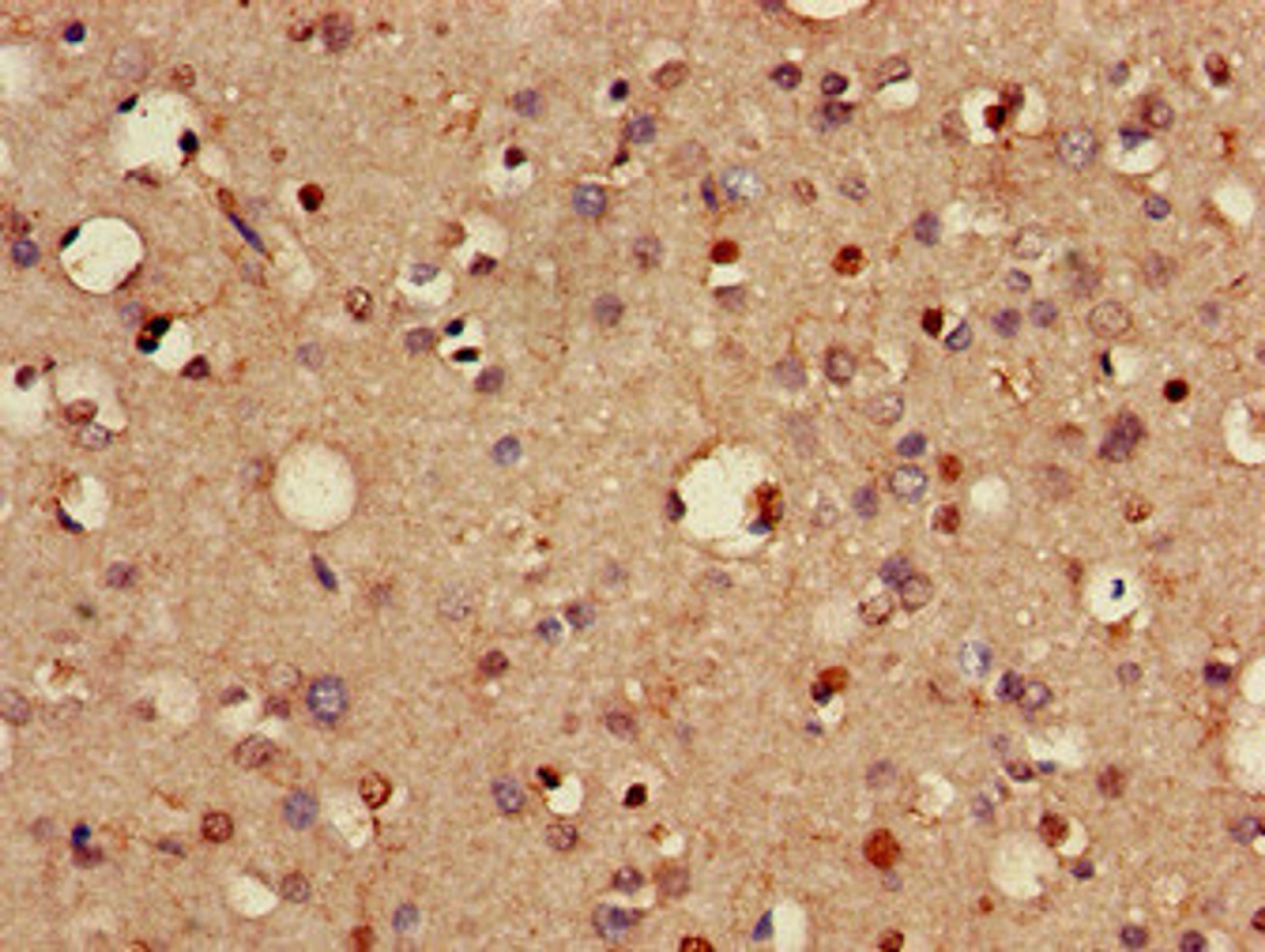 Immunohistochemistry of paraffin-embedded human brain tissue using CSB-PA842635LA01HU at dilution of 1:100