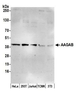 Detection of human and mouse AAGAB by WB.