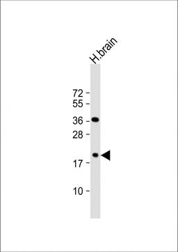 Western Blot at 1:1000 dilution + human brain lysate Lysates/proteins at 20 ug per lane.