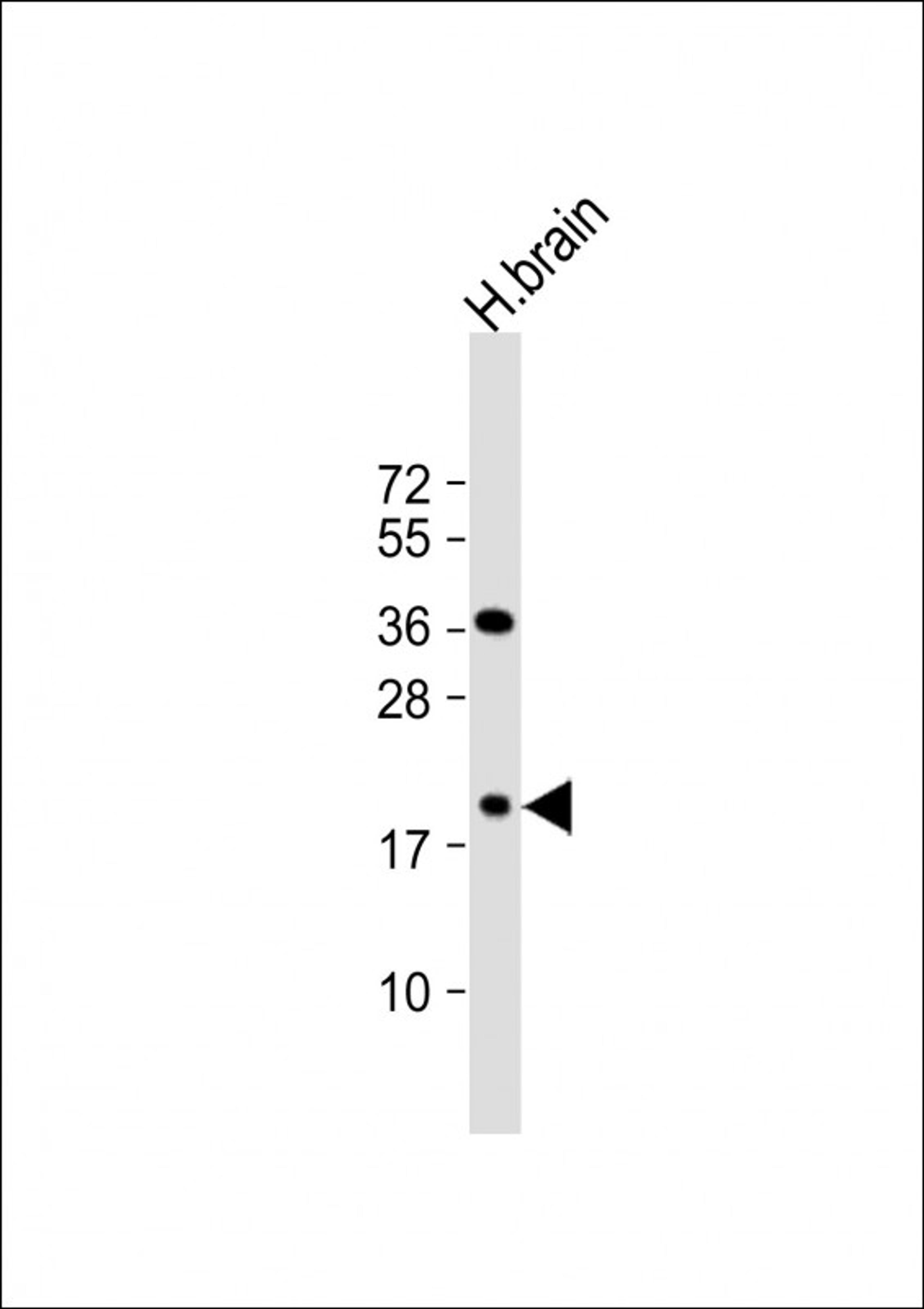 Western Blot at 1:1000 dilution + human brain lysate Lysates/proteins at 20 ug per lane.