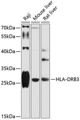 Western blot - HLA-DRB3 antibody (A12444)