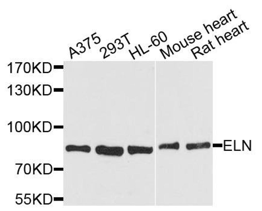 Western blot analysis of extracts of various cells using ELN antibody