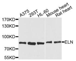 Western blot analysis of extracts of various cells using ELN antibody