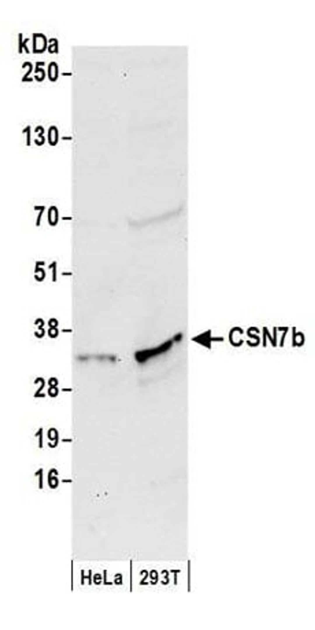 Detection of human CSN7b by western blot.