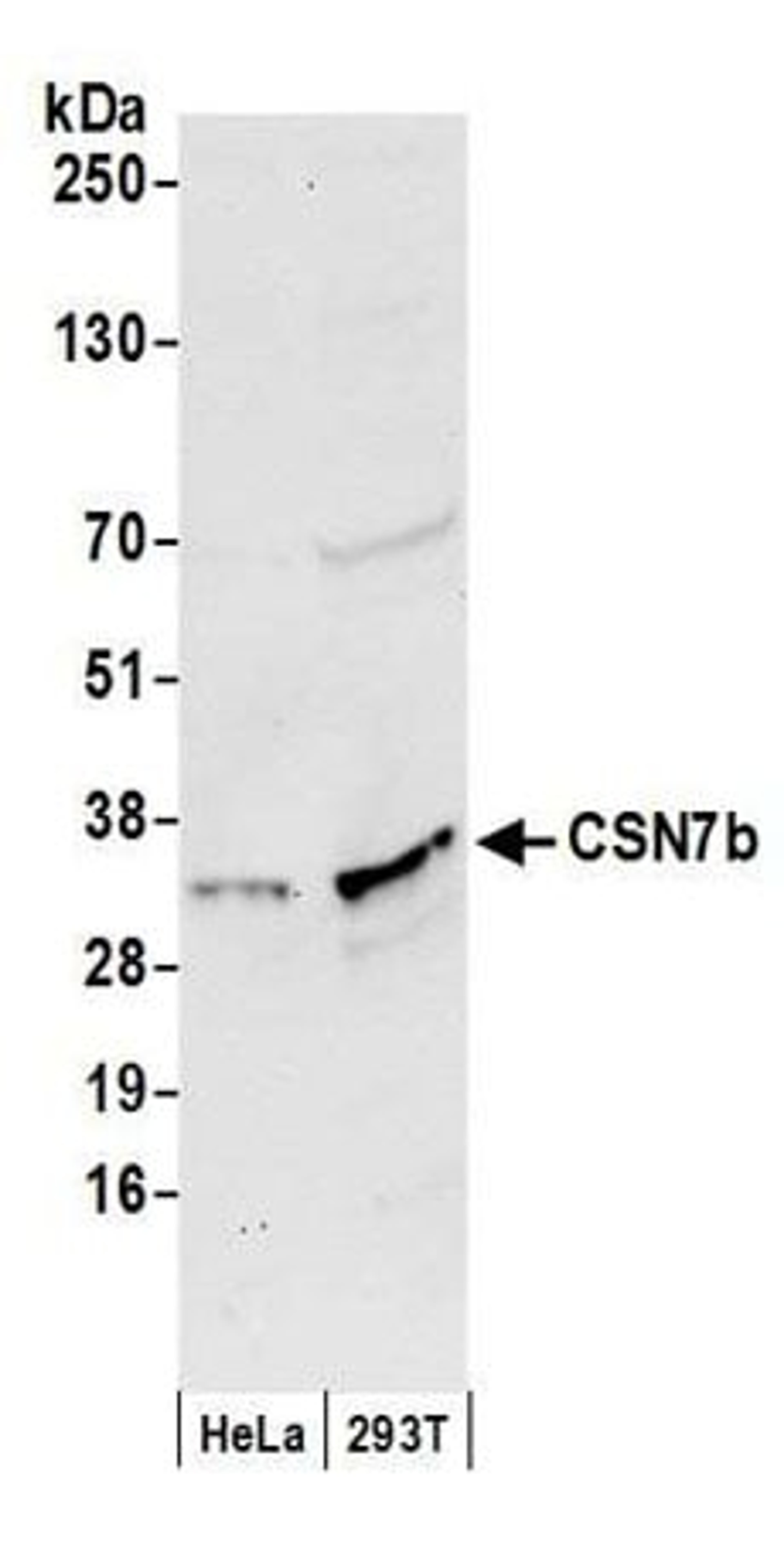 Detection of human CSN7b by western blot.