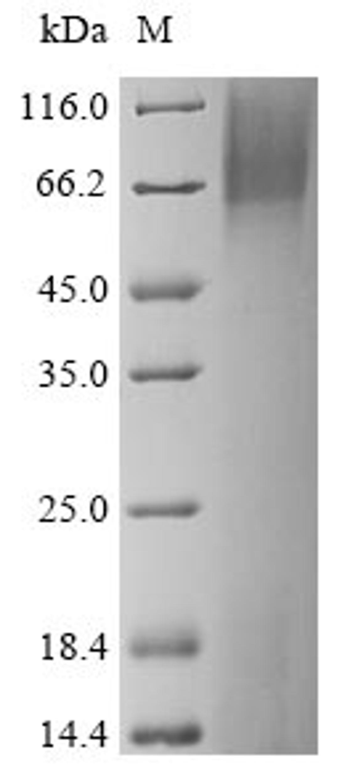(Tris-Glycine gel) Discontinuous SDS-PAGE (reduced) with 5% enrichment gel and 15% separation gel.