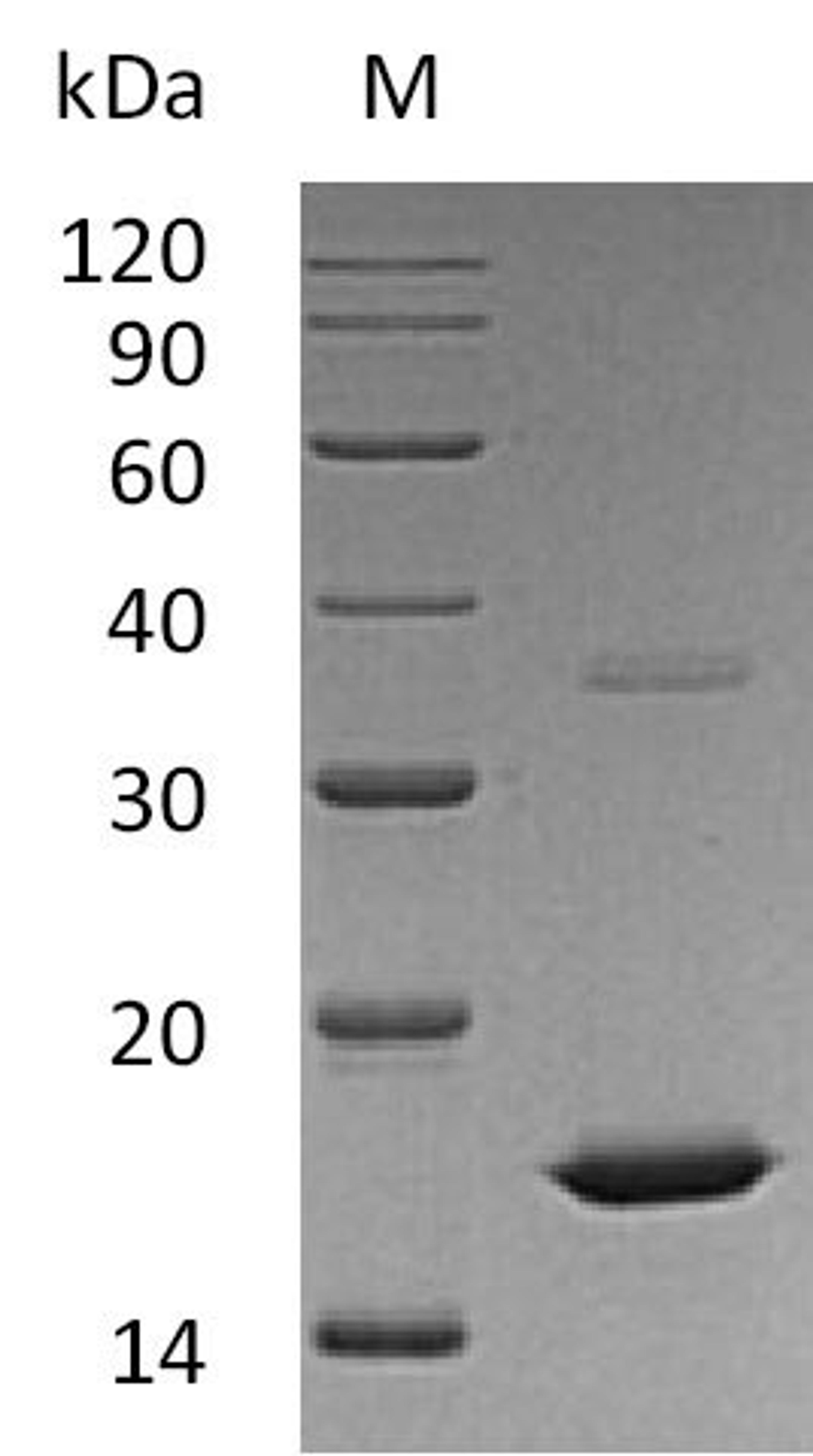 (Tris-Glycine gel) Discontinuous SDS-PAGE (reduced) with 5% enrichment gel and 15% separation gel.