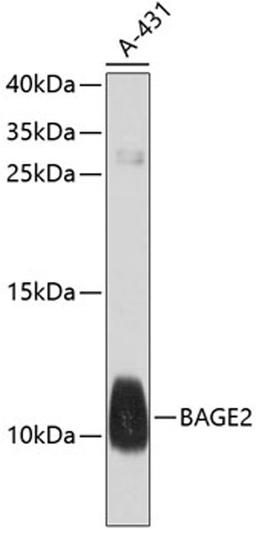 Western blot - BAGE2 antibody (A10159)