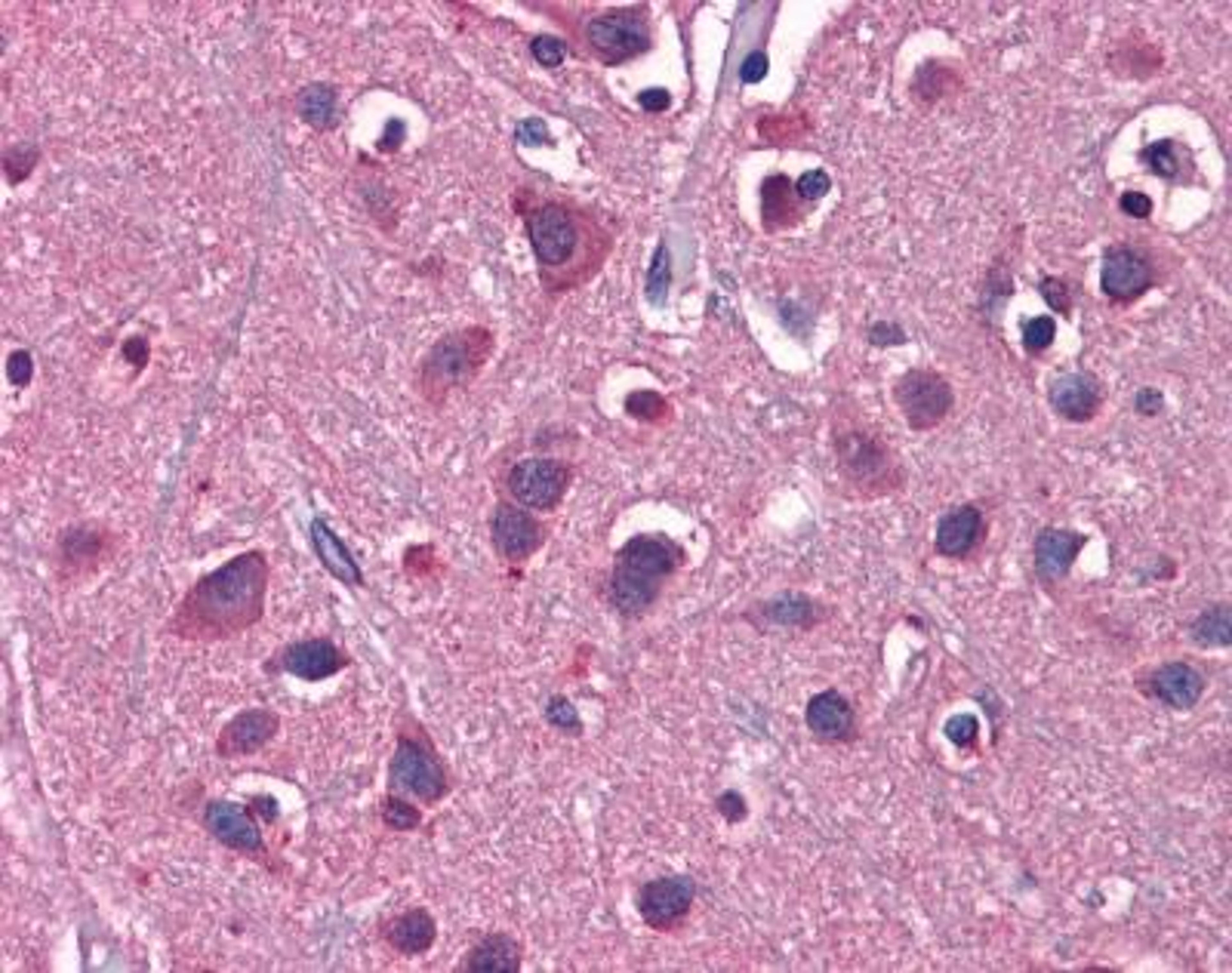 Immunohistochemistry-Paraffin: EAAT2/GLT1 Antibody [NBP1-59632] - Human Brain, cortex tissue at an antibody concentration of 5 ug/ml.