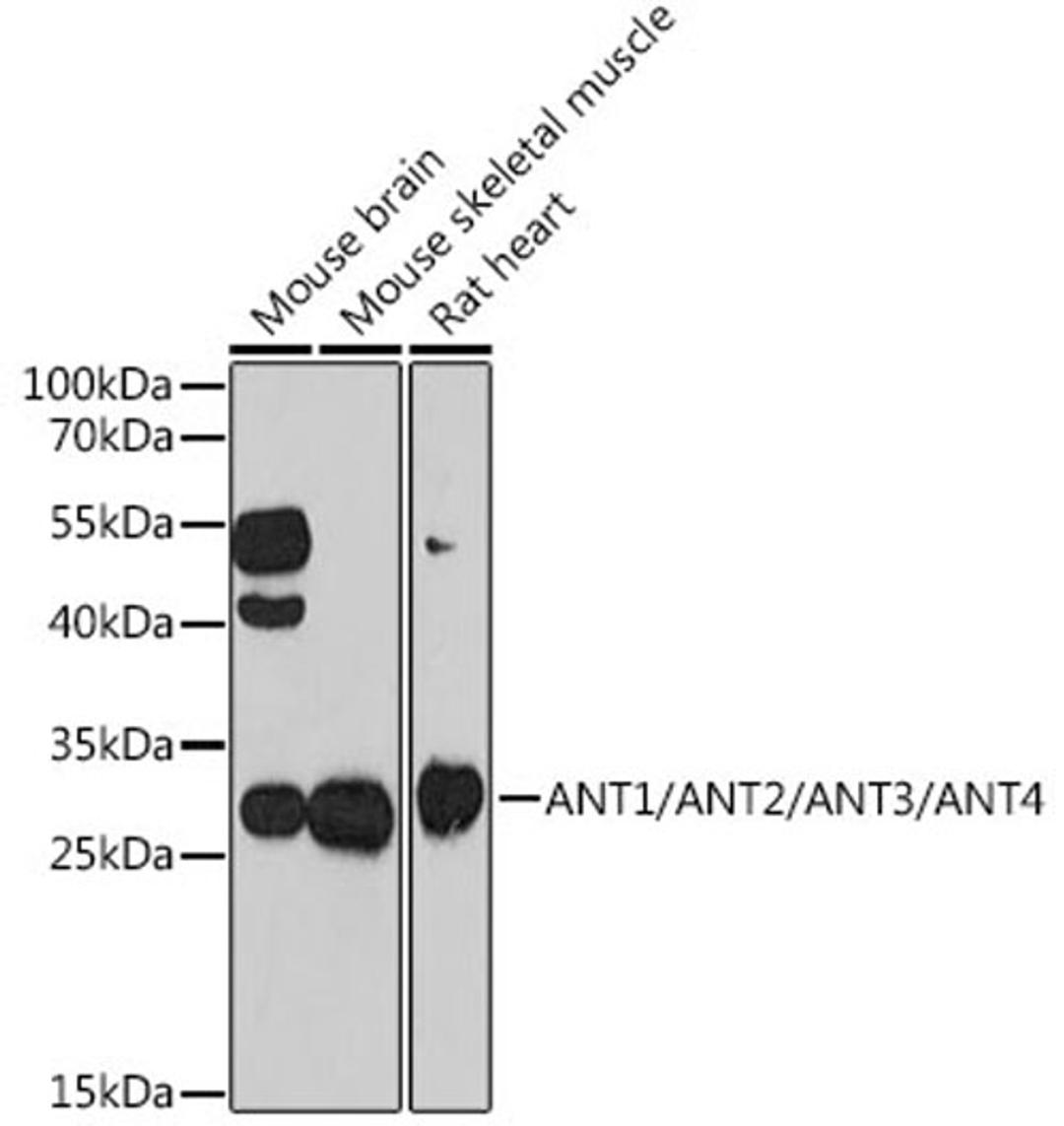 Western blot - ANT1/ANT2/ANT3/ANT4 antibody (A15988)