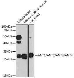 Western blot - ANT1/ANT2/ANT3/ANT4 antibody (A15988)