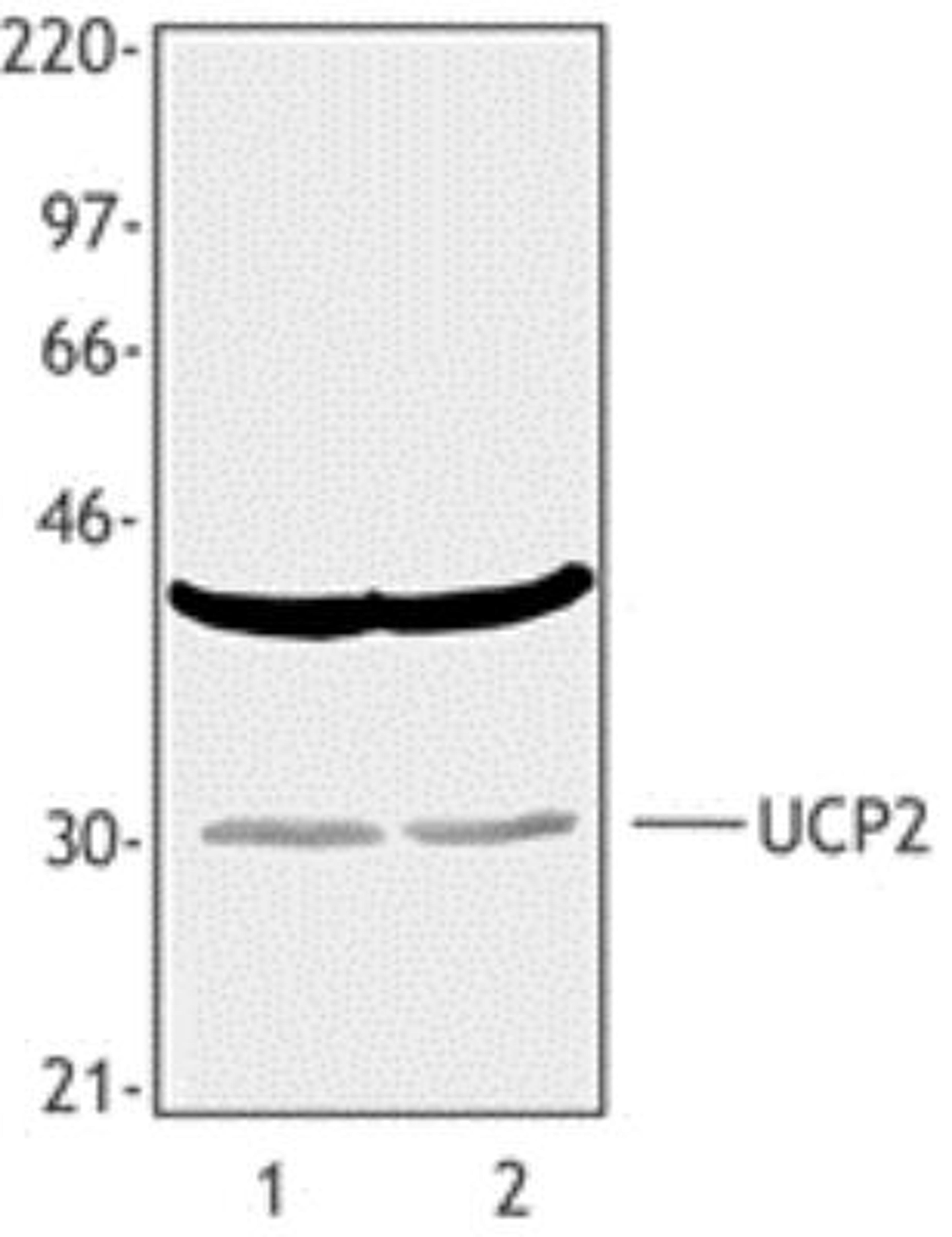 Western Blot: UCP2 Antibody [NB100-78377] - Tissue extracts from Mouse brain (Lane 1) or Rat brain (Lane 2) were resolved by electrophoresis, transferred to nitrocellulose, and probed with polyclonal anti-UCP2 antibody. Proteins were visualized using a goat anti-rabbit secondary conjugated to HRP and a chemiluminescence detection system.