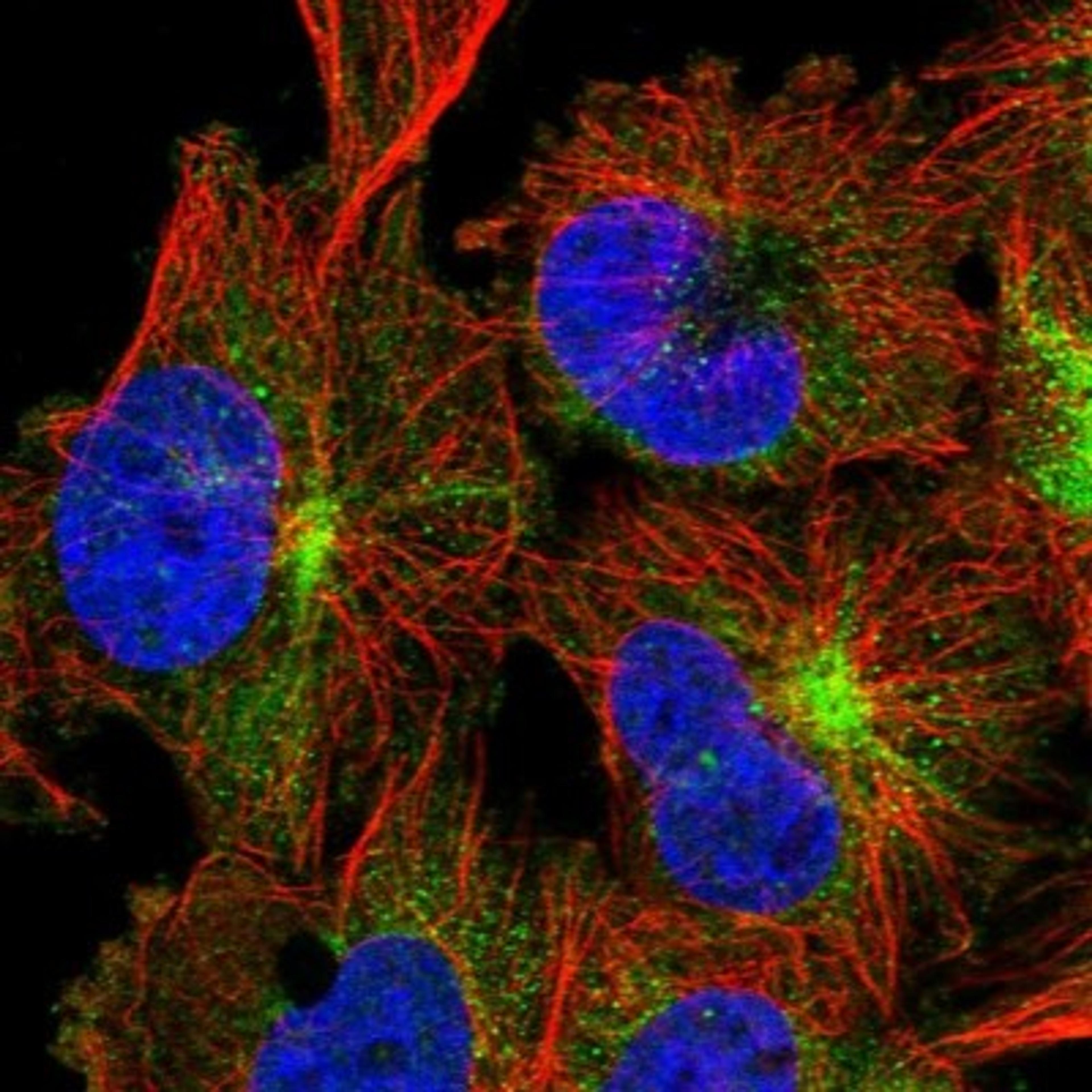 Immunocytochemistry/Immunofluorescence: TRIM46 Antibody [NBP1-82088] - Staining of human cell line U-251MG shows positivity in cytoplasm & cytoskeleton (intermediate filaments).