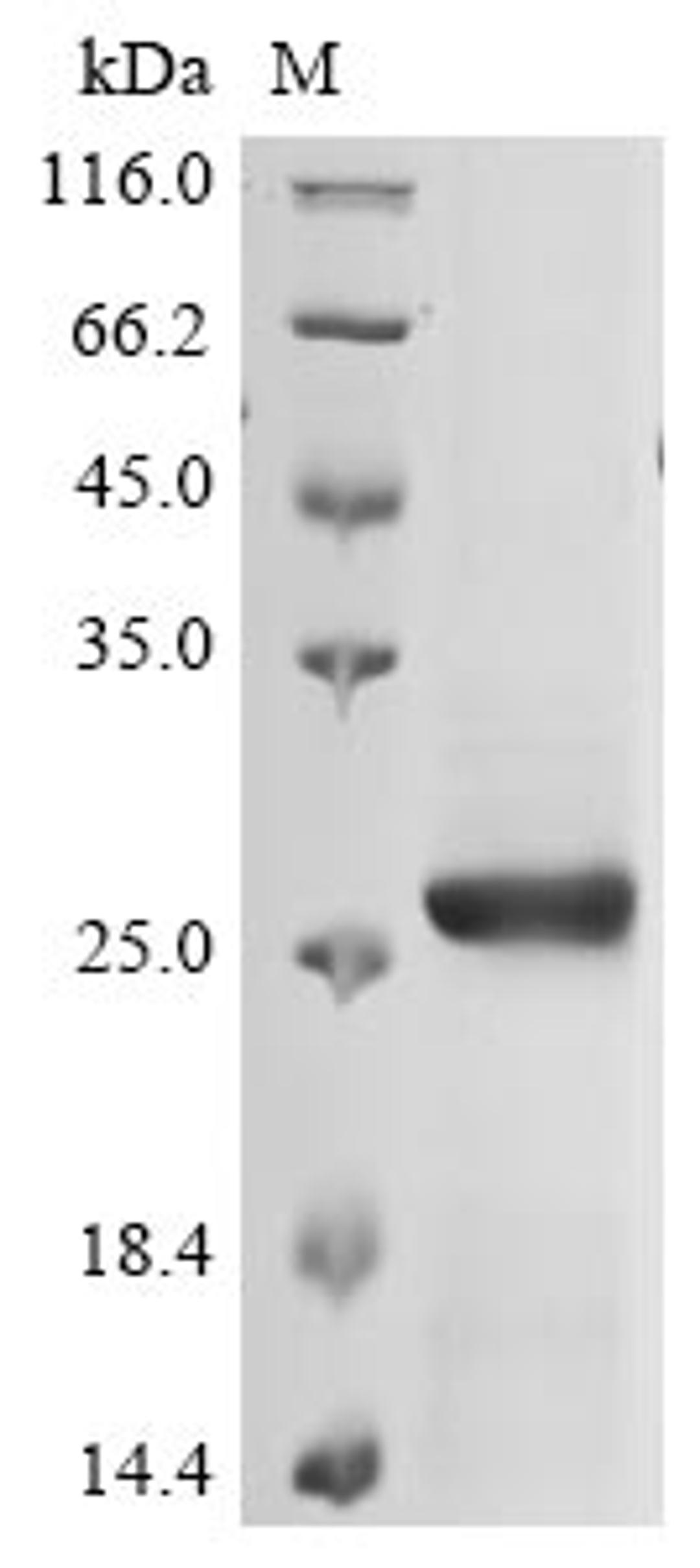 (Tris-Glycine gel) Discontinuous SDS-PAGE (reduced) with 5% enrichment gel and 15% separation gel.