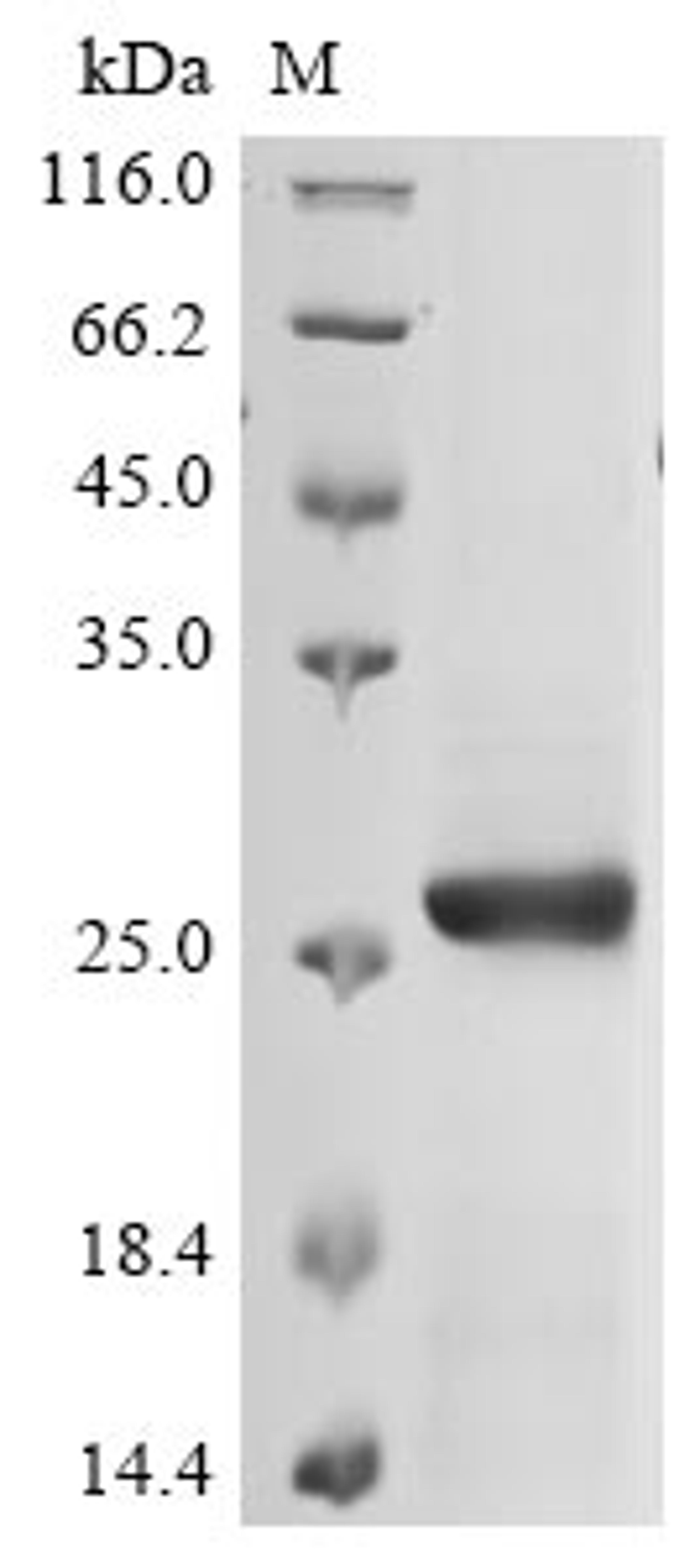 (Tris-Glycine gel) Discontinuous SDS-PAGE (reduced) with 5% enrichment gel and 15% separation gel.