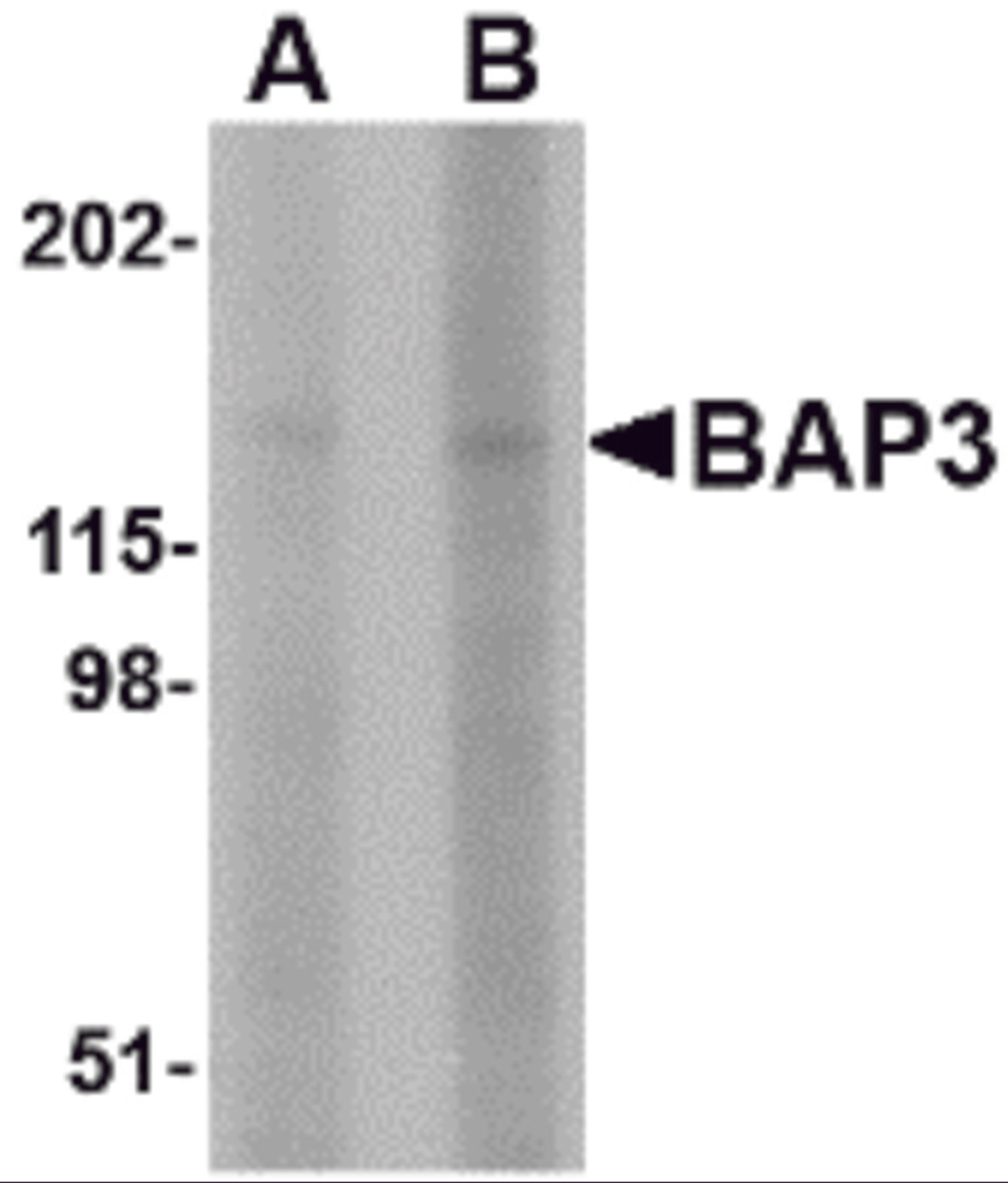 Western blot analysis of BAP3 in SK-N-SH cell lysate with BAP3 antibody at (A) 1 and (B) 2 &#956;g/mL.