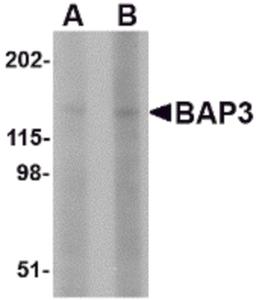 Western blot analysis of BAP3 in SK-N-SH cell lysate with BAP3 antibody at (A) 1 and (B) 2 μg/mL.
