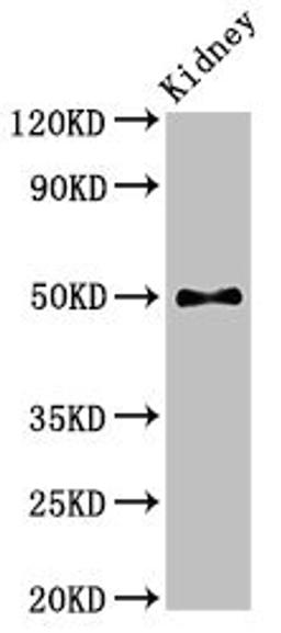 Western Blot. Positive WB detected in: Mouse kidney tissue. All lanes: PDK1 antibody at 2.8ug/ml. Secondary. Goat polyclonal to rabbit IgG at 1/50000 dilution. Predicted band size: 50, 52 kDa. Observed band size: 50 kDa. 