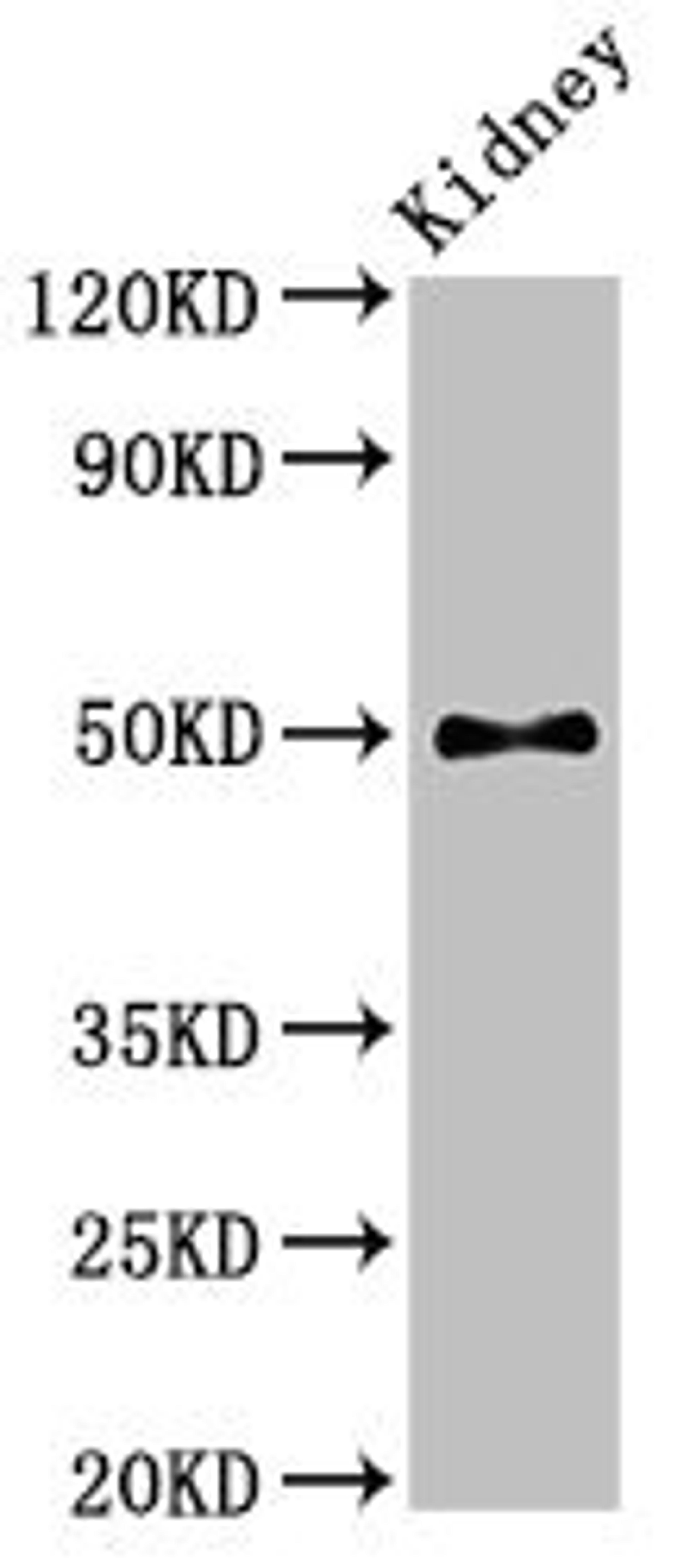 Western Blot. Positive WB detected in: Mouse kidney tissue. All lanes: PDK1 antibody at 2.8ug/ml. Secondary. Goat polyclonal to rabbit IgG at 1/50000 dilution. Predicted band size: 50, 52 kDa. Observed band size: 50 kDa. 