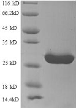 (Tris-Glycine gel) Discontinuous SDS-PAGE (reduced) with 5% enrichment gel and 15% separation gel.