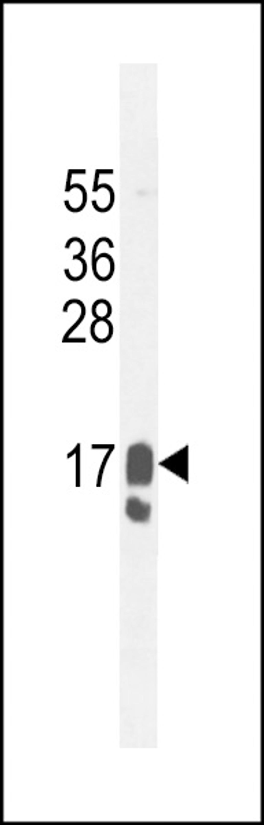 Western blot analysis in MDA-MB231 cell line lysates (35ug/lane).