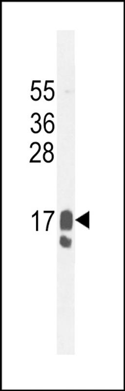 Western blot analysis in MDA-MB231 cell line lysates (35ug/lane).