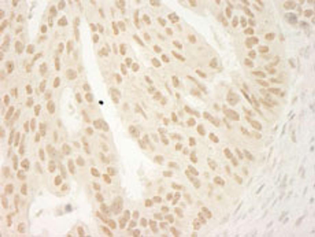 Detection of human CTNND1 by immunohistochemistry.