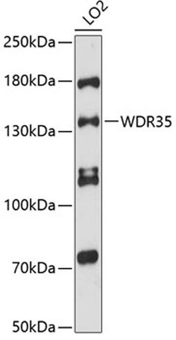 Western blot - WDR35 antibody (A12824)