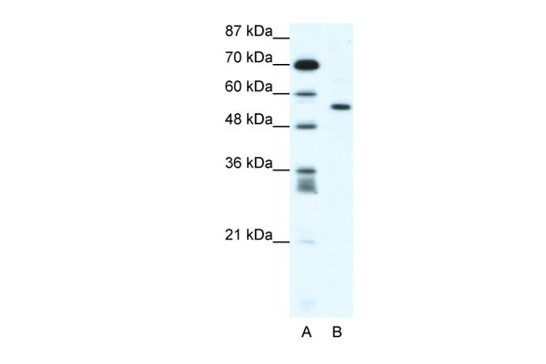 Antibody used in WB on Human Jurkat 1.25 ug/ml.