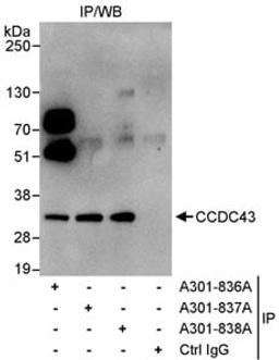 Detection of human CCDC43 by western blot of immunoprecipitates.