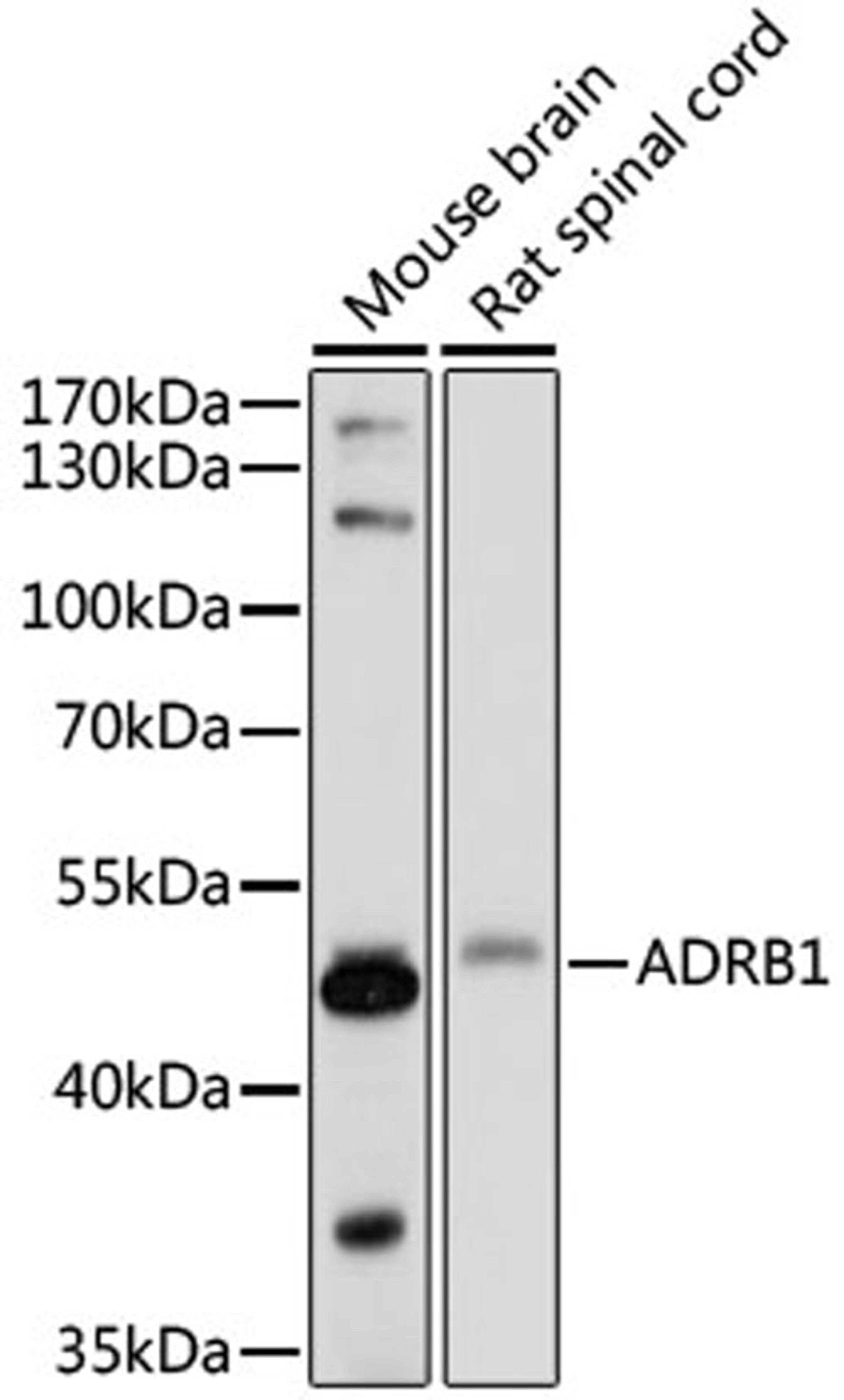 Western blot - ADRB1 antibody (A16334)