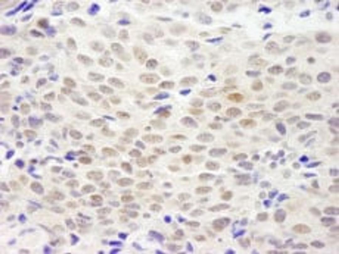 Detection of human XLF by immunohistochemistry.