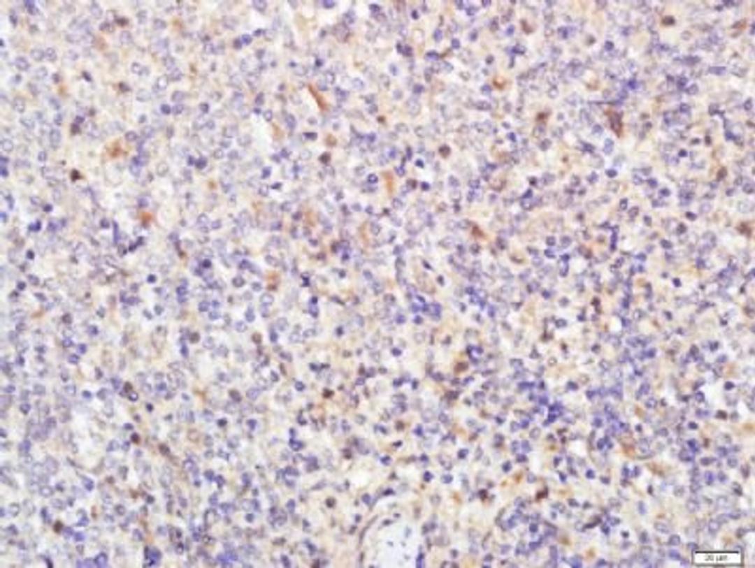 Immunohistochemical staining of rat spleen tissue using Activated Notch1 antibody.